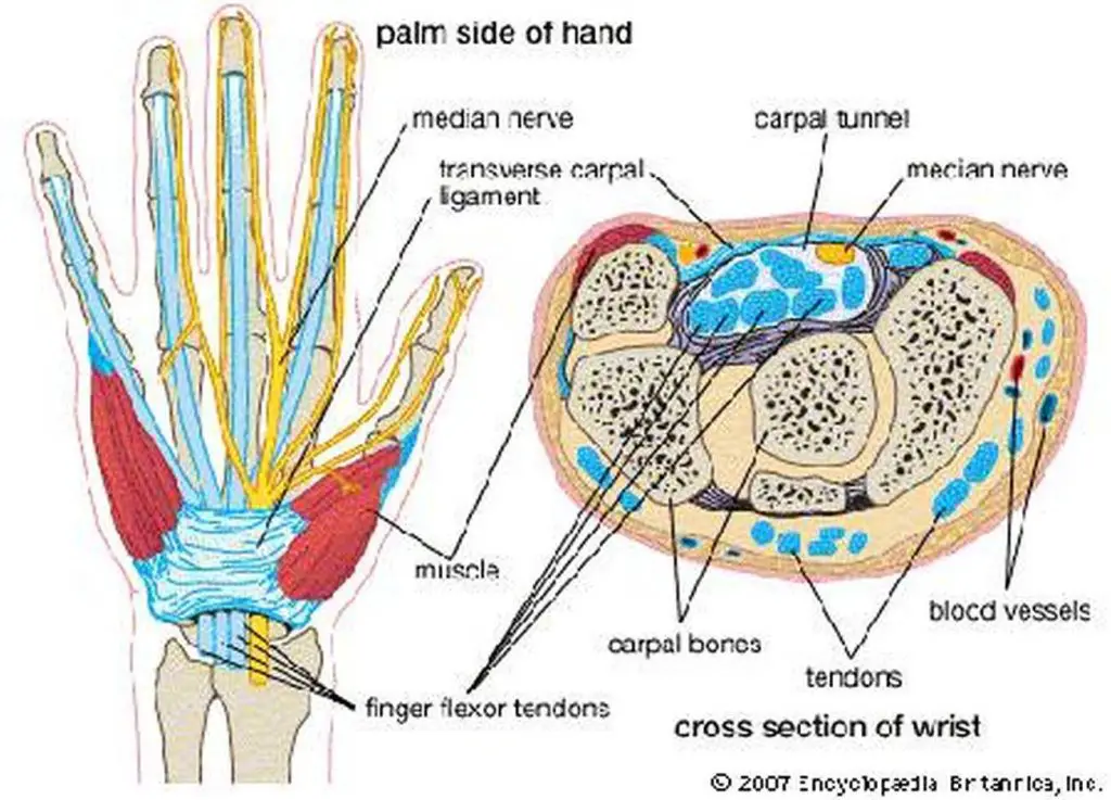 Pictures Of Carpal Tunnel