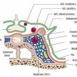 Pictures Of Cavernous Sinus