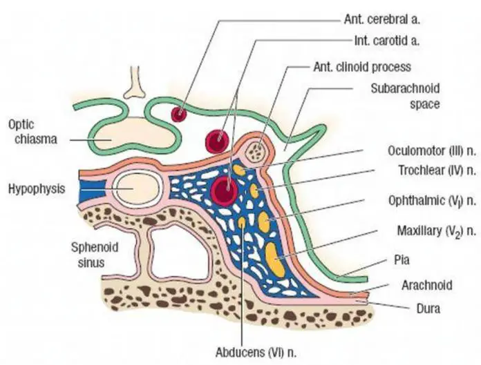 Pictures Of Cavernous Sinus