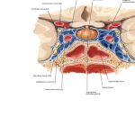 Pictures Of Cavernous Sinus