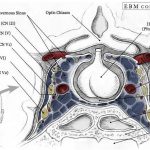Pictures Of Cavernous Sinus