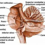 Pictures Of Cerebellar Peduncles