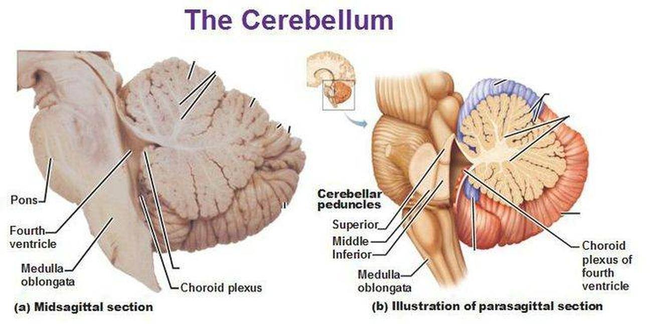 Pictures Of Cerebellar Peduncles