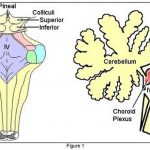 Pictures Of Cerebellar Peduncles