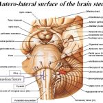 Pictures Of Cerebellar Peduncles