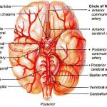 Pictures Of Cerebral Arteries