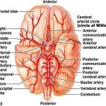 Pictures Of Cerebral Arteries