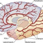 Pictures Of Cerebral Arteries