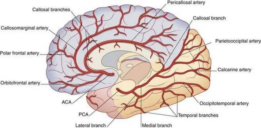 Pictures Of Cerebral Arteries