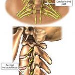 Pictures Of Cervical Spinal Nerve