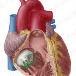 Pictures Of Chordae Tendineae