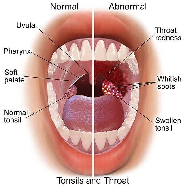 Tonsils diagram