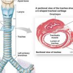 Trachea diagram
