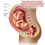 Uterus diagram