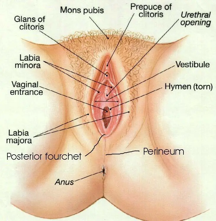 Cross section of female vesicovaginal fistula medical illustration, anatomy