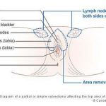 Vulva diagram