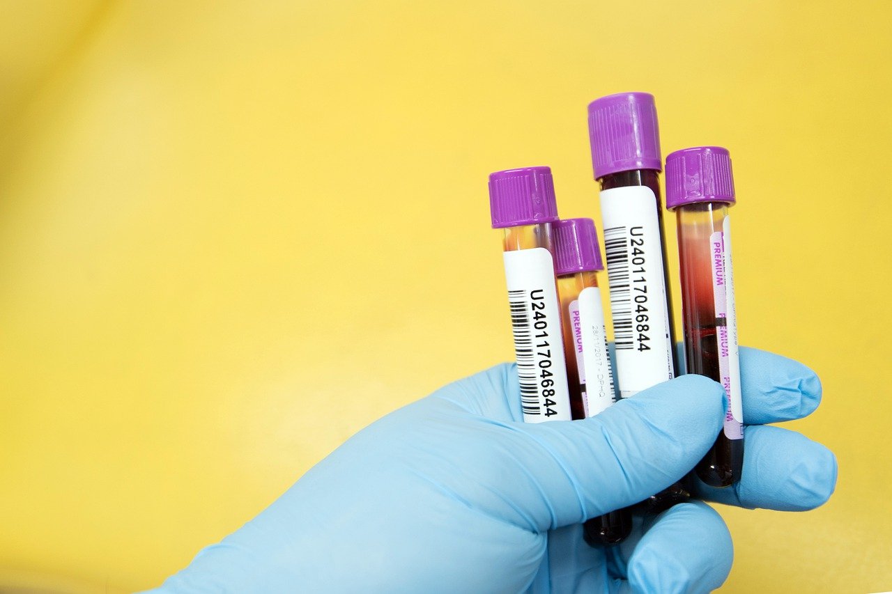 blood-sample-test
