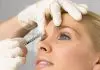 8 Things to Know Before Having Botox