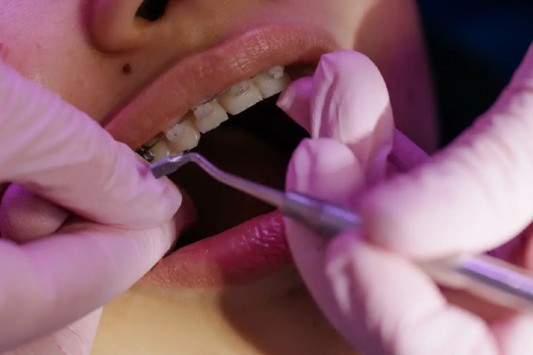 bracers-dentist