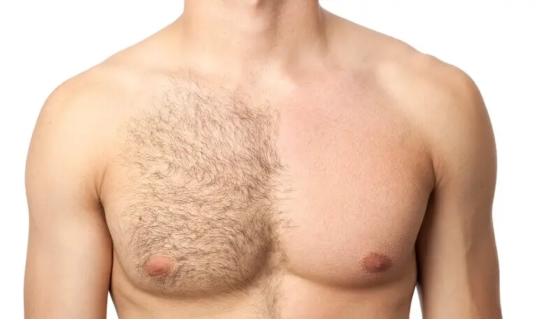 chest-hair