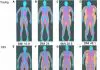 dexa body fat percentage scan