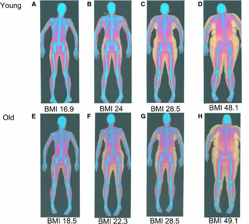 dexa scan body fat percentage