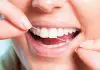 5 Tips to Taking Care Of Your Teeth