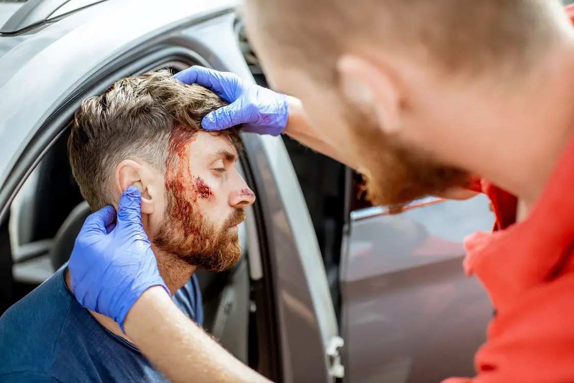 head-injury-car-accident