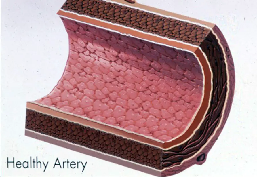 healty-artery