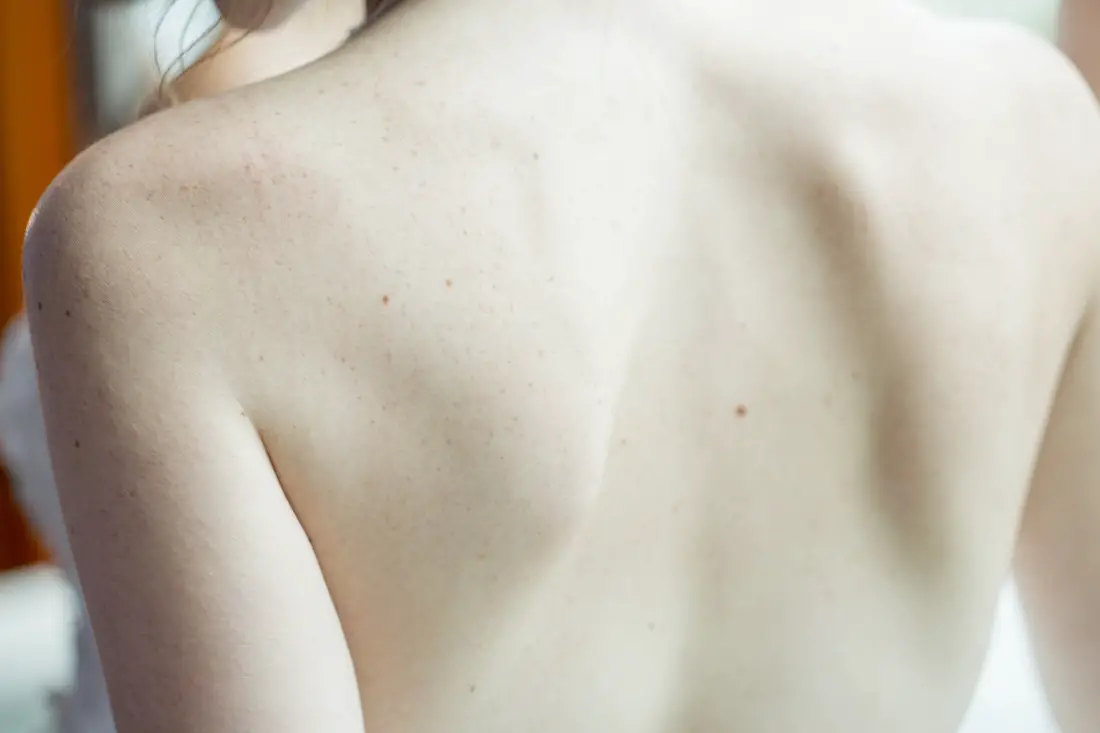 skin-shoulder