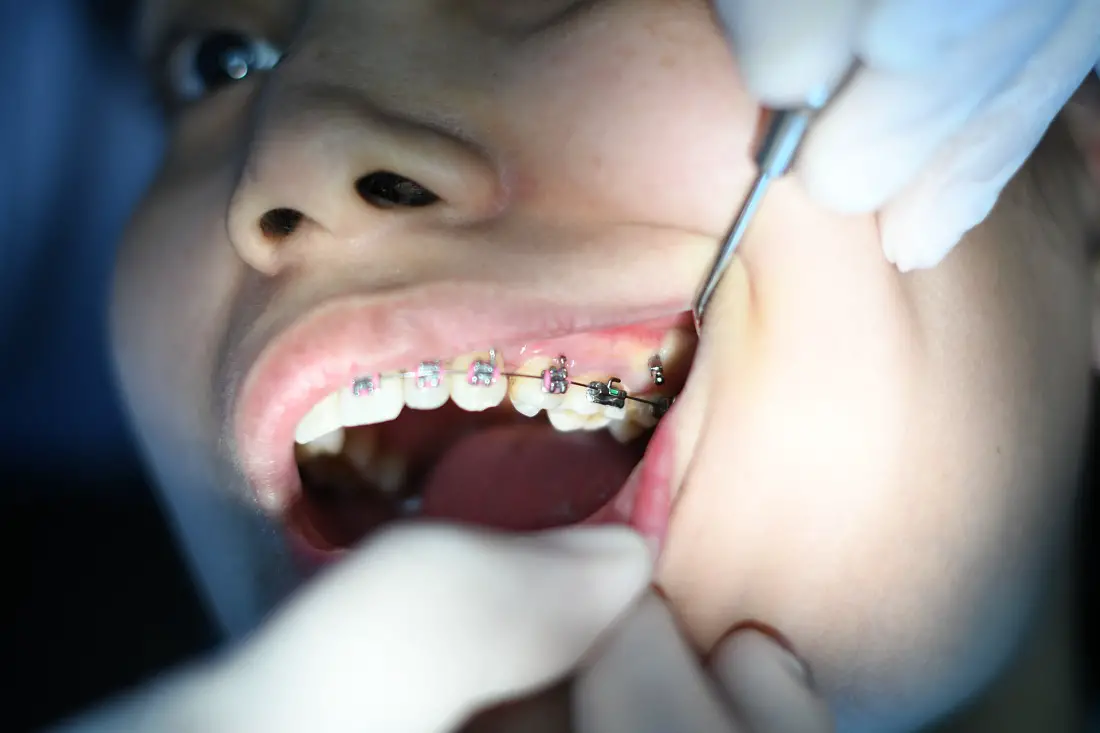 teeth-dentist